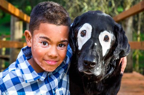 vitiligo une menino e cãozinho
